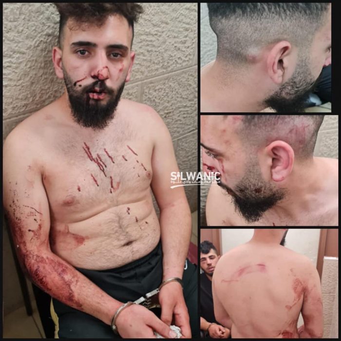 warga palestina dipukuli israel