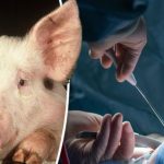 transplantasi organ babi